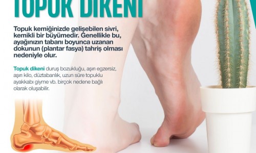 Topuk Dikeni